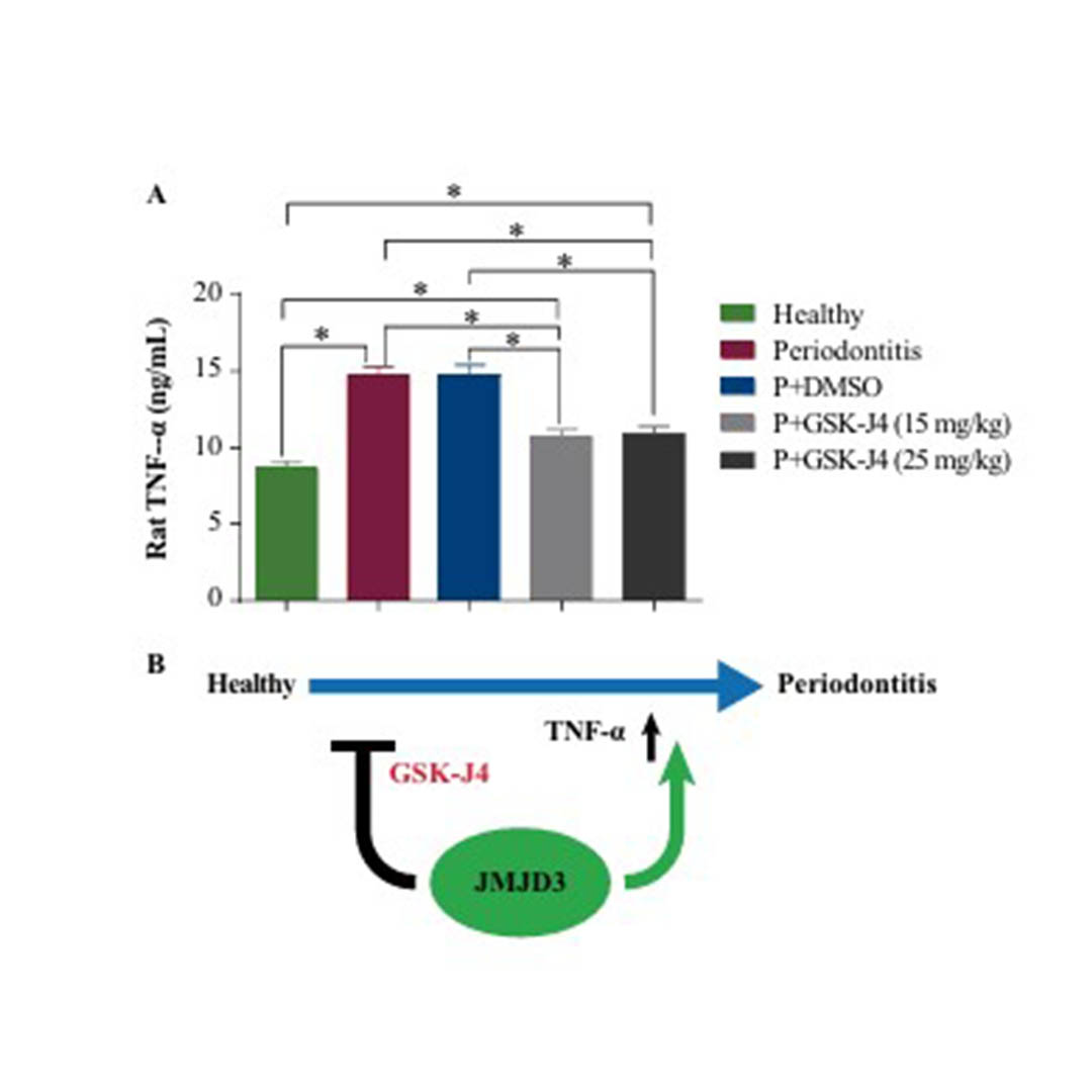 cmedicalscience's tweet photo. This study highlights how GSK‑J4 reduces bone loss and #inflammation in rat periodontitis by targeting JMJD3. Epigenetic modulation may transform future treatment strategies.
Read: https://t.co/jckrYBw4Ed
#currentmedicalscience #Dentistry #JMJD3 #Epigenetics https://t.co/x1E4LzqIOa