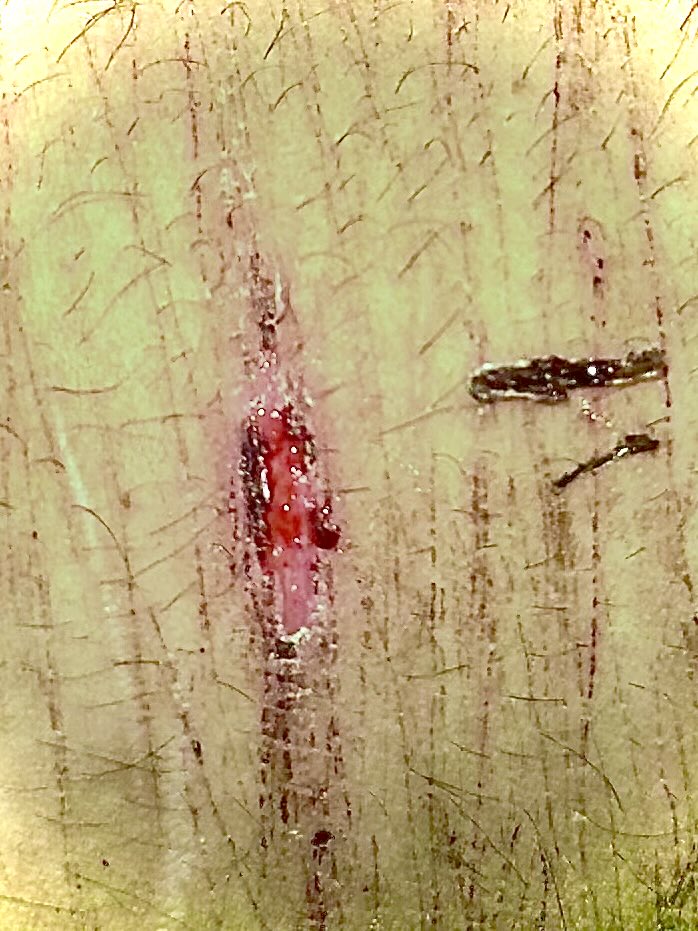 blessureMatyr's tweet photo. Okay so im a fucking wimp https://t.co/BmCq2j0p6l