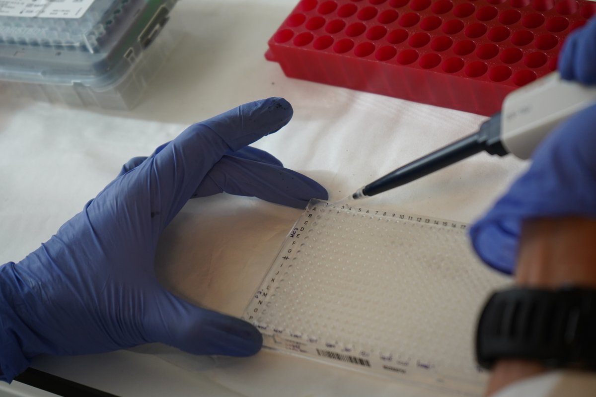 vallhebron's tweet photo. 🔬 #VallHebron desenvoluparà un nou tractament tòpic contra el lupus eritematós discoide.

En models animals, la formulació ha reduït el 90% les lesions cutànies sense detectar el fàrmac a la sang.

🎯 L’objectiu és avançar cap a un futur assaig clínic.

https://t.co/WU3kttM7fP https://t.co/ZzyCuBpYzg