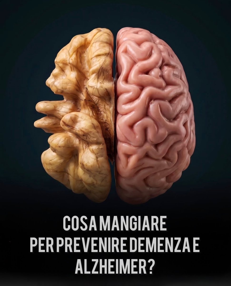 ProfMBassetti's tweet photo. 🧠 Proteggere il cervello potrebbe iniziare anche a tavola.

Quasi il 45% dei casi di demenza potrebbe essere collegato a fattori di rischio modificabili, secondo le evidenze raccolte dalla Lancet Commission.
Tra questi: pressione alta, diabete, colesterolo elevato, sedentarietà e altri fattori legati allo stile di vita.
La genetica conta, ma non è tutto. Anche le scelte quotidiane possono fare la differenza. ❤️

🥗 E quale alimentazione può aiutare?
I ricercatori indicano la dieta MIND, un modello alimentare che combina elementi della dieta Mediterranea e della DASH, con particolare attenzione agli alimenti associati alla salute cerebrale.
🍓 Frutti di bosco 🥬 Verdure, soprattutto quelle a foglia verde 🌾 Cereali integrali 🥜 Frutta secca 🫒 Olio extravergine d’oliva e altri grassi insaturi

E, al tempo stesso, limita il consumo di carni rosse, grassi saturi, fritti e alimenti ultra-processati.
L’idea è semplice: privilegiare alimenti ricchi di antiossidanti e sostanze con proprietà antinfiammatorie, inseriti in un’alimentazione equilibrata, può contribuire a proteggere la salute cardiovascolare e cerebrale nel tempo.

🫀 Ciò che fa bene al cuore può fare bene anche al cervello.
Prendersi cura della propria salute cognitiva non richiede una soluzione miracolosa: può iniziare da piccole scelte quotidiane, anche da ciò che metti nel piatto oggi.

⚠️ La dieta non può garantire di prevenire l’Alzheimer o altre forme di demenza, ma uno stile di vita sano può contribuire a ridurre alcuni fattori di rischio.
👉 La prevenzione comincia dalle abitudini. E anche la tua alimentazione fa parte di questa storia.

Fonte: Willmoth, H. (2026). This is the single best diet to help prevent dementia, according to a Harvard professor. BBC Science Focus Magazine.

#DietaMIND #SaluteDelCervello #Prevenzione #Demenza #Alzheimer