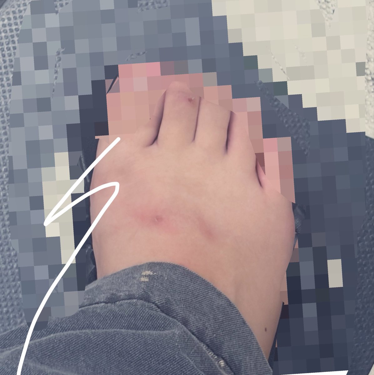 ma_se_00's tweet photo. いたい https://t.co/jWkRJUgcX9