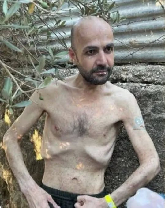 Fartou57's tweet photo. Non non, détrompez vous !
Ce n'est pas 1 vieille photo d'1 rescapé des camps de la mort.
C'est celle d'1 palestinien libéré des prisons israeliennes !!! https://t.co/qFjew81QBM