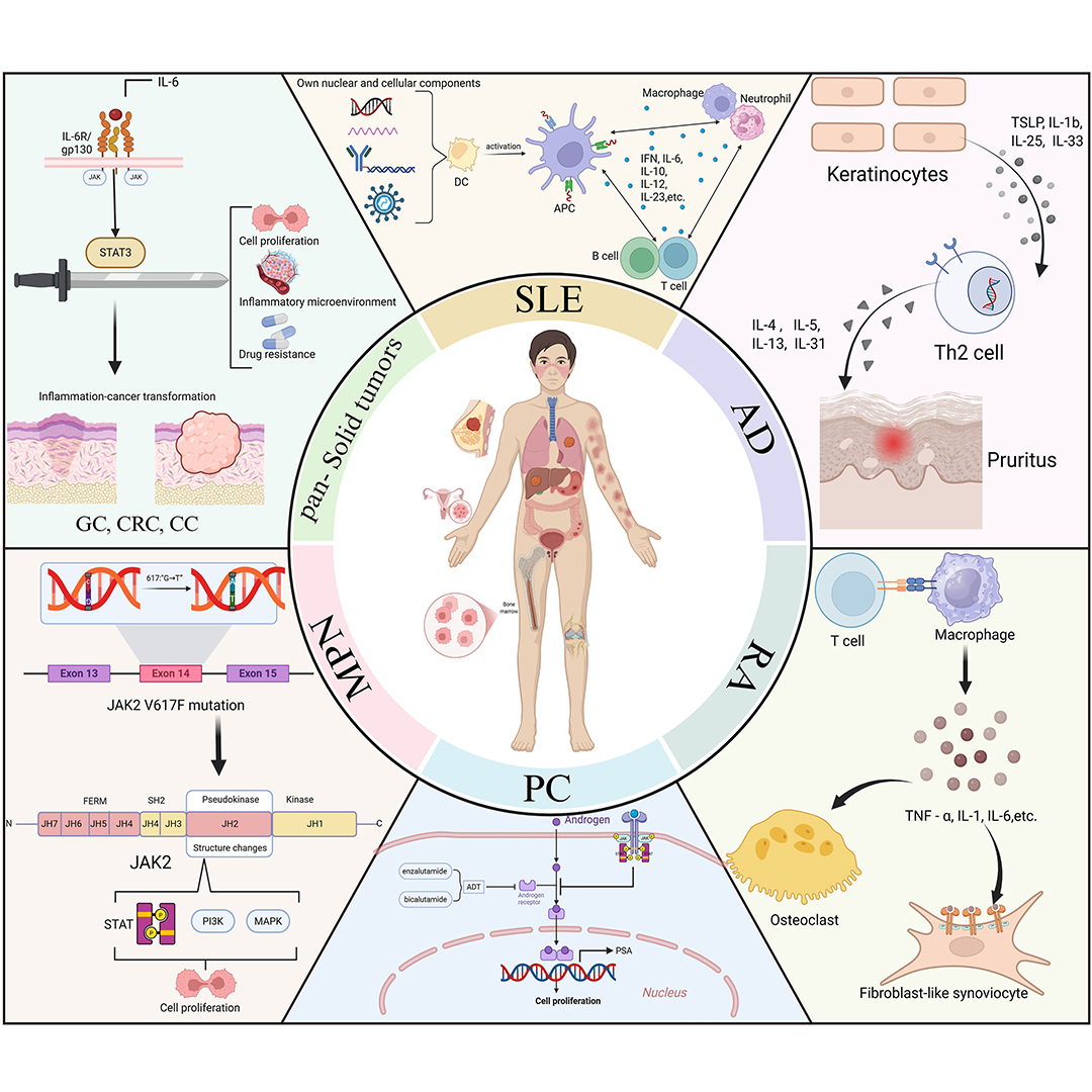 GenesNDiseases's tweet photo. Is #JAKSTAT a friend or foe in #SolidTumors?
This review reveals paradoxical roles, showing how direct inhibition fuels immune exhaustion and proposes system‑level targeting to overcome the impasse. @zzu_china
#GenesAndDiseases: https://t.co/fO5Gua7zEf https://t.co/jZiNQs5sMX
