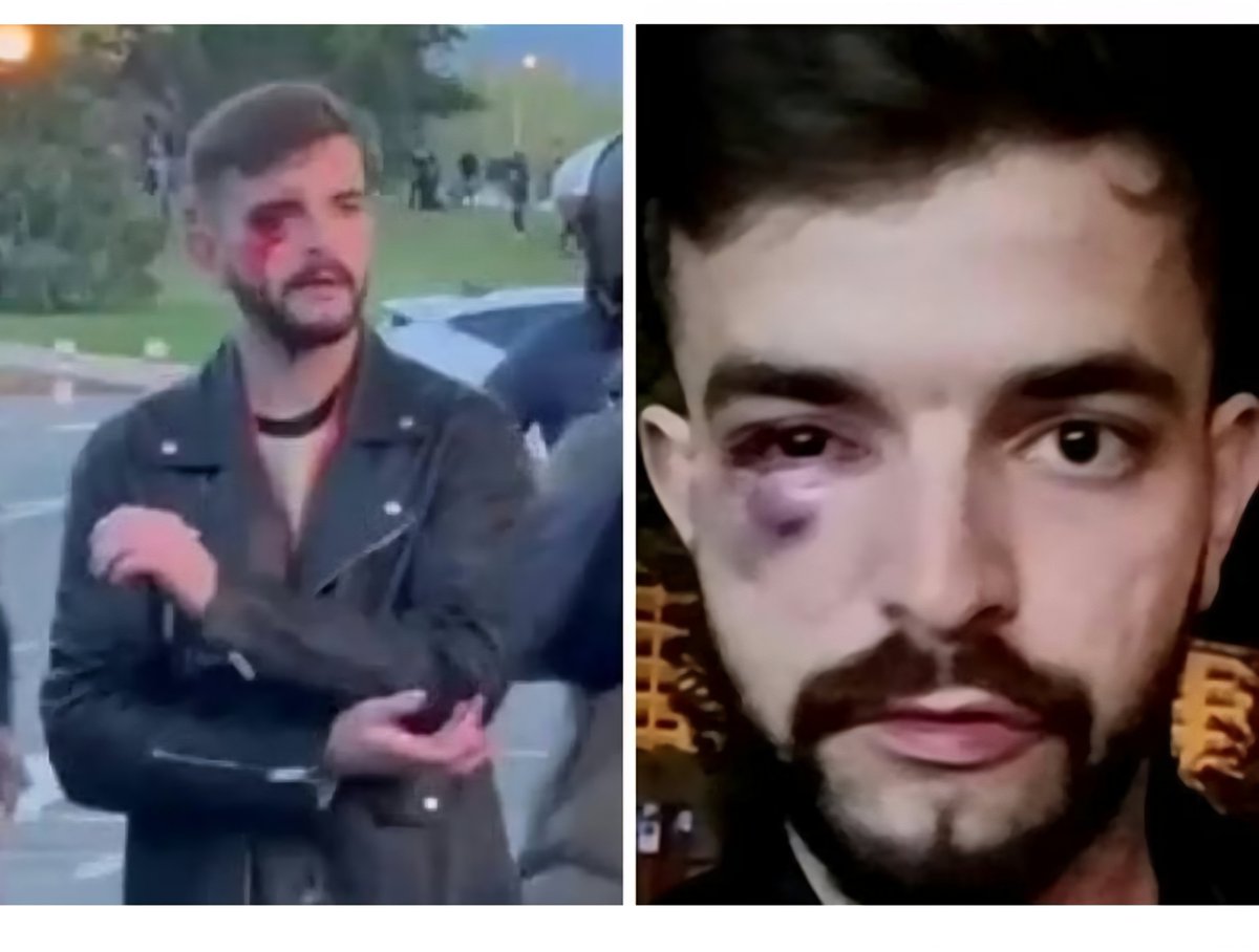 philipauscas's tweet photo. @xaquindashervas @loretoochando @MalasLenguas_Tv @loretoochando esto que dices ya pasó, pero en aquel entonces no fuiste tan vehemente ni hablaste con tanta indignación.Incluso tu compañera @menoscanas alabo la agresión. No engañas a nadie. https://t.co/gLnsZWAeTi