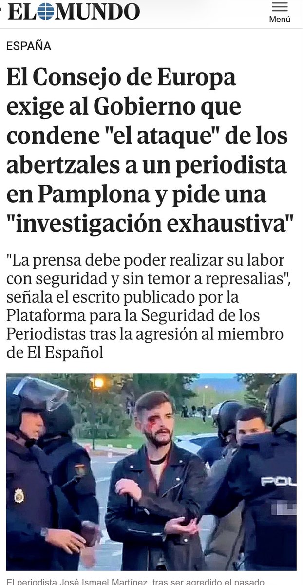 Noininski's tweet photo. @Almarbar1372 @vox_es @ppopular El PSOE, SUMAR  ya han reventado y casi matado a un periodista del mundo. https://t.co/iSW6fjCS9E