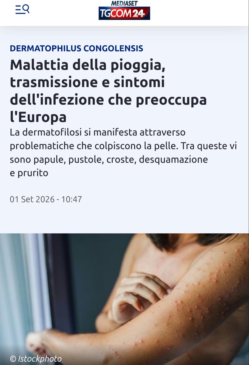 Livythinker's tweet photo. La chiamano la malattia della pioggia https://t.co/b4Mv7y7Q6C