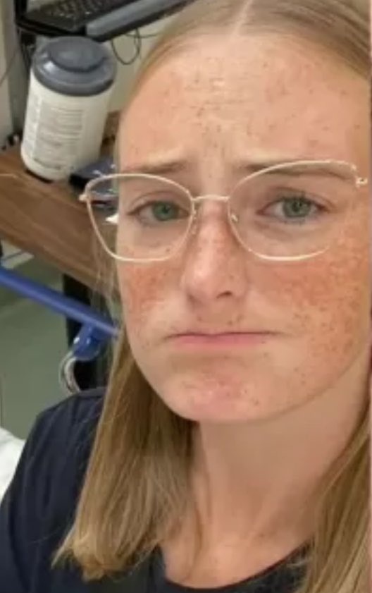 choquei's tweet photo. 🚨URGENTE: Jovem fica cega após hábito de tomar banho com as lentes de contato: “Antes disso acontecer, ninguém nunca tinha me dito que não pode.” https://t.co/gfAdFiIR2r