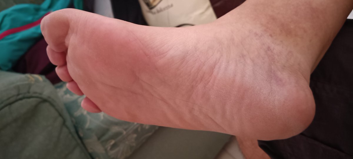 mysweetmalefeet's tweet photo. Day feet
more at https://t.co/gpF6RUxRw5

#feet #feetfetısh  #feetworshi̇p #feetfetıshly  #feettobuy
#buyingfeetpics #buyfeetpics https://t.co/OjoMojZwGj