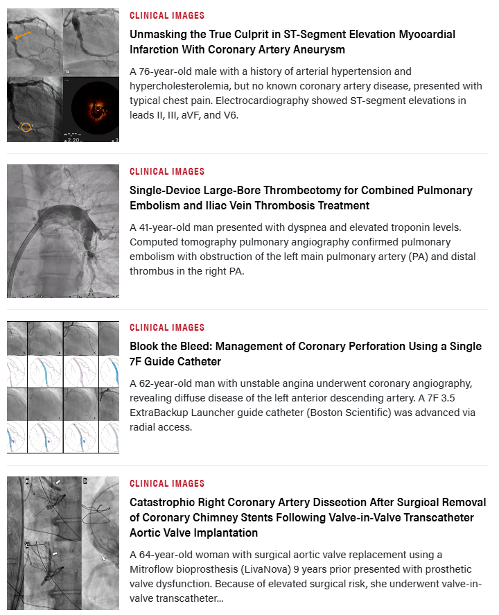 InvasiveCardiol's tweet photo. 📚 The September issue is out now! Read here: https://t.co/Gh1VTAh1aj

@AqamarMD @elaaha_a @LeilaAlizadehMD @RoyaMousavi_MD @GilbertTangMD @LucySafi @KHERA_MD @SaminKSharma @AmithoodaMD @DLBHATTMD 

#cardioTwitter #cardioX #cardiology #interventionalcardiology https://t.co/CUGaWKuk7L