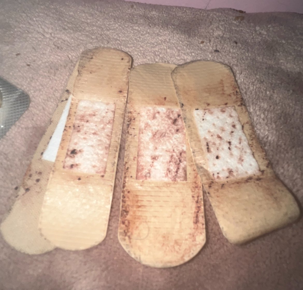 kangelscake's tweet photo. Look I painted my plasters! 🙂‍↕️🪽 https://t.co/H0KFgL68vi