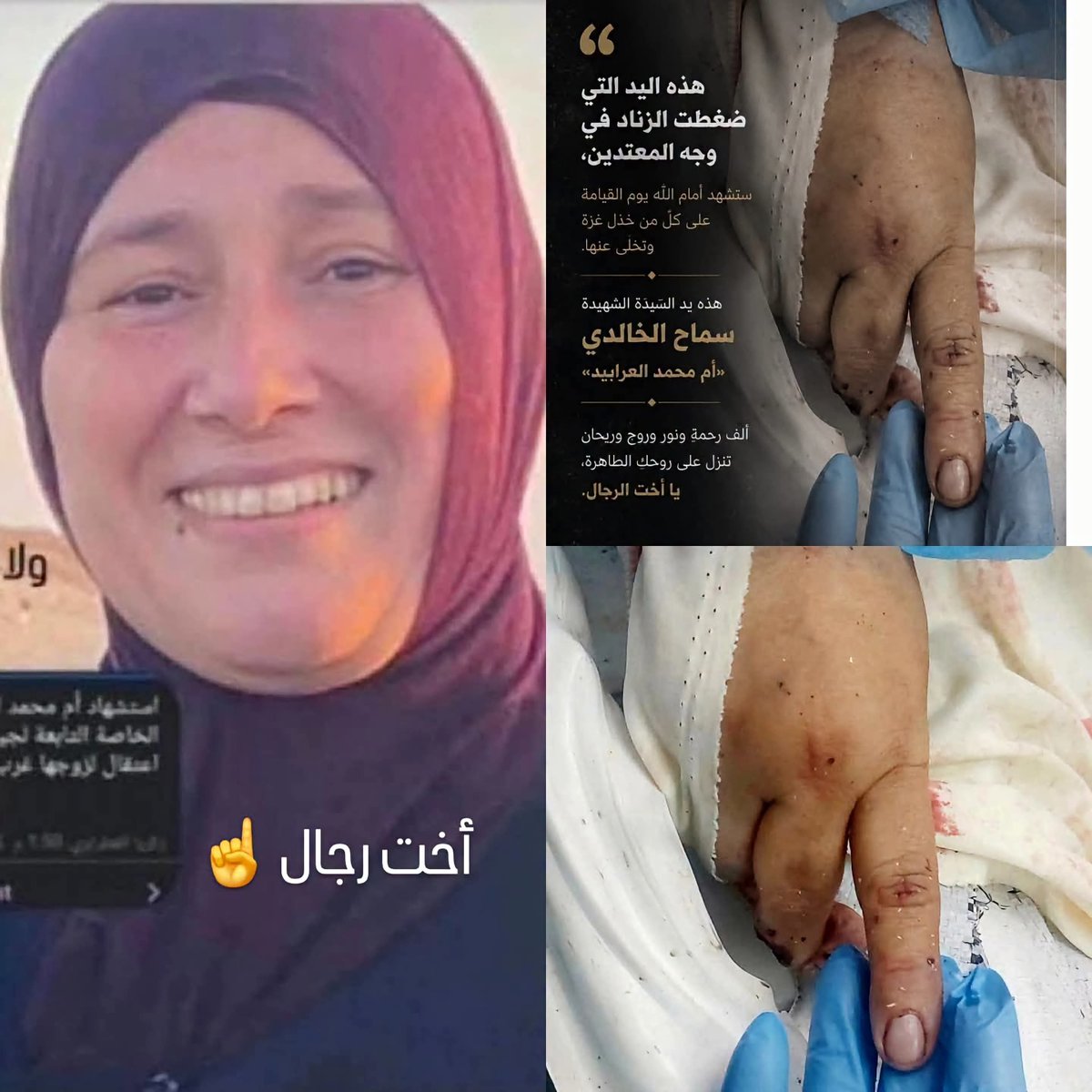 mazen00711's tweet photo. اليد الطاهرة المتوضأة التي ضغطت الزناد في وجه المعتدين

أتعبتي من بعدك من الرجال يا سماح https://t.co/dSQrbcF5Aw