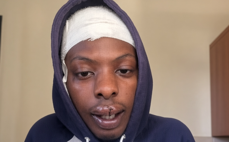K24Tv's tweet photo. TikToker Victor Chege reveals traumatic encounter with thieves after Derrick Omollo’s death.

Read the full story here:https://t.co/O68rMmumek https://t.co/tSa6iDQyhX