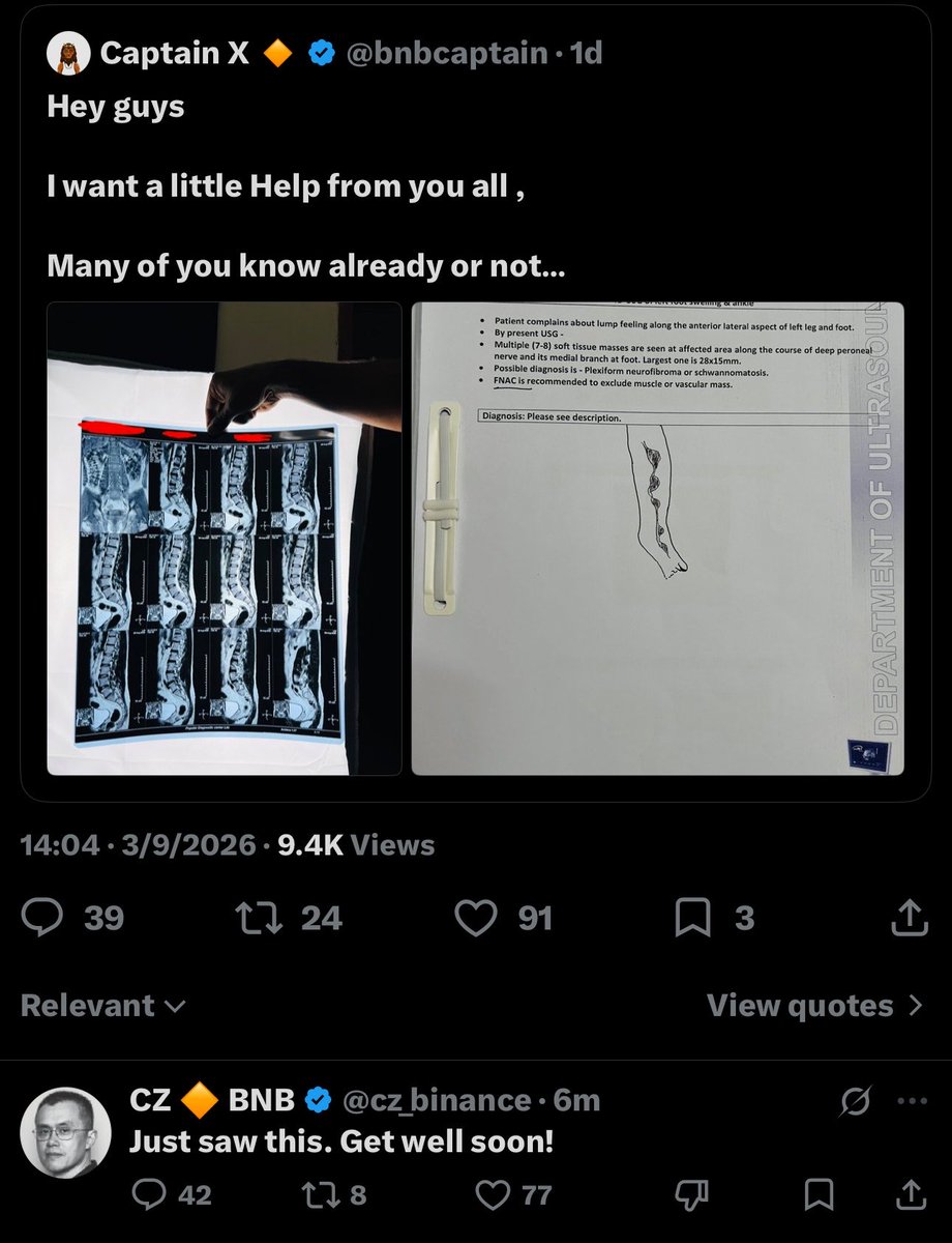 ashar_cryptoxrp's tweet photo. Who else watched this ClipX skyrocket !!
CZ effect 

This is not AI ., this is CLipX 🔥🔥🔥I was online when it happened https://t.co/cX52XsU6va