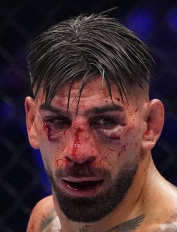 Linglongehl's tweet photo. @thomas_ant24919 @Mambawizmma Since you're an Apturo Topturo fan https://t.co/j9bWR7GTt4