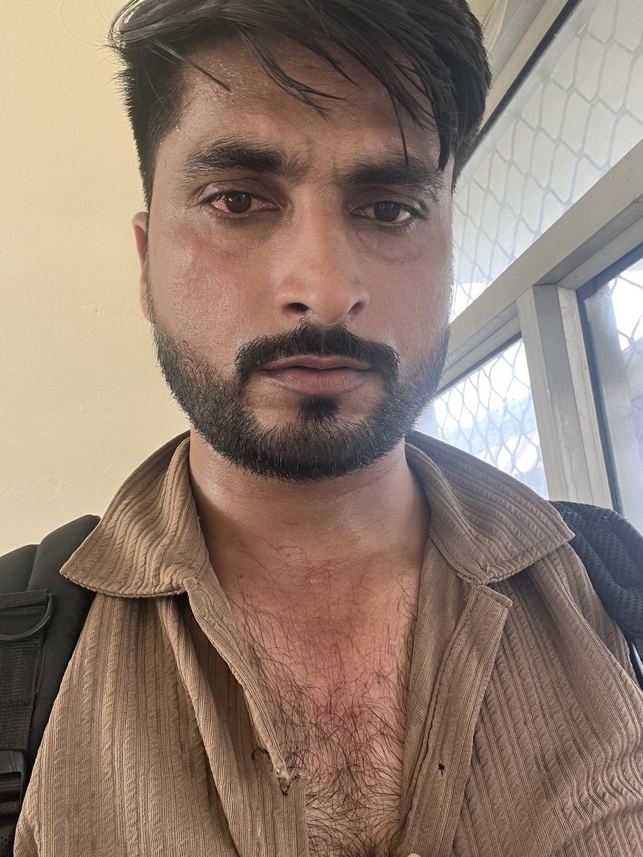 jsktravelogue's tweet photo. आज दिनांक 03.09.2026 को मैं ट्रेन संख्या 19031 Yoga Express से Meerut से Haridwar यात्रा कर रहा था। यात्रा के दौरान पानी एवं अन्य खाद्य सामग्री की कथित overcharging पाए जाने पर मैंने साक्ष्यों सहित Railway में शिकायत दर्ज की।

Haridwar Railway Station पर ट्रेन से उतरते समय Platform No. 2 पर कुछ व्यक्तियों द्वारा मुझे घेर लिया गया। मेरे साथ कथित रूप से मारपीट की गई, मोबाइल फोन छीनने का प्रयास किया गया तथा मुझे जान से मारने की धमकी दी गई।

उक्त व्यक्तियों में Nauman नामक व्यक्ति भी शामिल था, जिसकी फोटो/वीडियो मैं इस पोस्ट के साथ संलग्न कर रहा हूं। लगभग 8–9 माह पूर्व भी मेरी overcharging complaint के बाद उक्त व्यक्ति द्वारा मुझे कथित रूप से गाली-गलौज एवं आपत्तिजनक टिप्पणियां की गई थीं।

📍 घटना: Haridwar Railway Station, Platform No. 2
🚆 Train: 19031 Yoga Express
📅 Date: 03.09.2026
🎫 PNR: 8552966146

स्टेशन परिसर में CCTV cameras उपलब्ध हैं। अतः संबंधित CCTV footage को तत्काल सुरक्षित (preserve) किया जाए, ताकि साक्ष्य से घटना की निष्पक्ष जांच हो सके।

@RailMinIndia @RailwaySeva @RPF_INDIA @GRP_Haridwar

कृपया शिकायत का तत्काल संज्ञान लेकर आरोपियों की पहचान, CCTV एवं अन्य उपलब्ध साक्ष्यों की जांच तथा लागू कानून के अंतर्गत उचित FIR/कानूनी कार्रवाई सुनिश्चित की जाए।