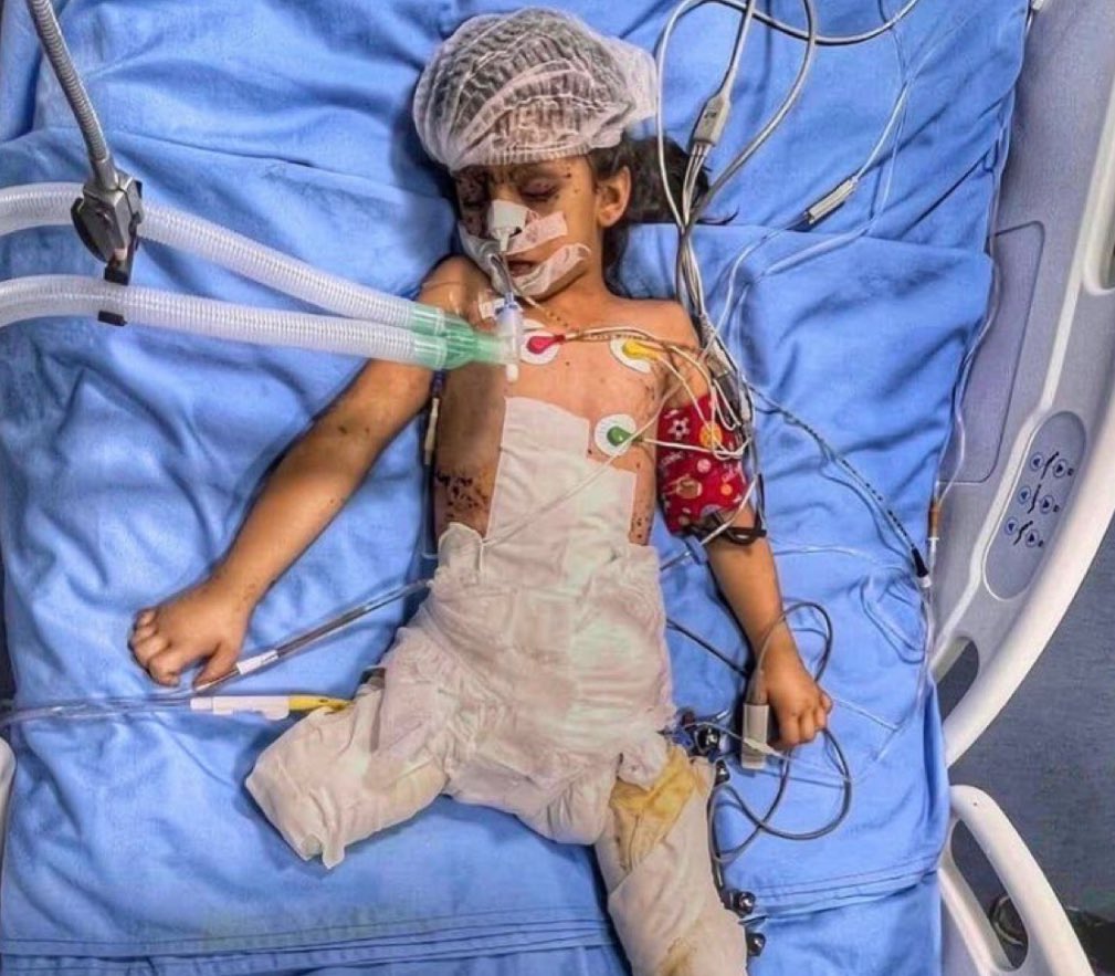 DanielSeddon2's tweet photo. Do you support Palestine?
Yes
No
Children of Gaza.
#Israël #Gaza #GazaUnderAttack #freepalestine #supportgaza #PrayForGaza #fypシ゚viral #امہ_کی_شان_عاصم_منیر #FreeGaza #GazaChildren #trending #war #help https://t.co/0MMaATFMAJ