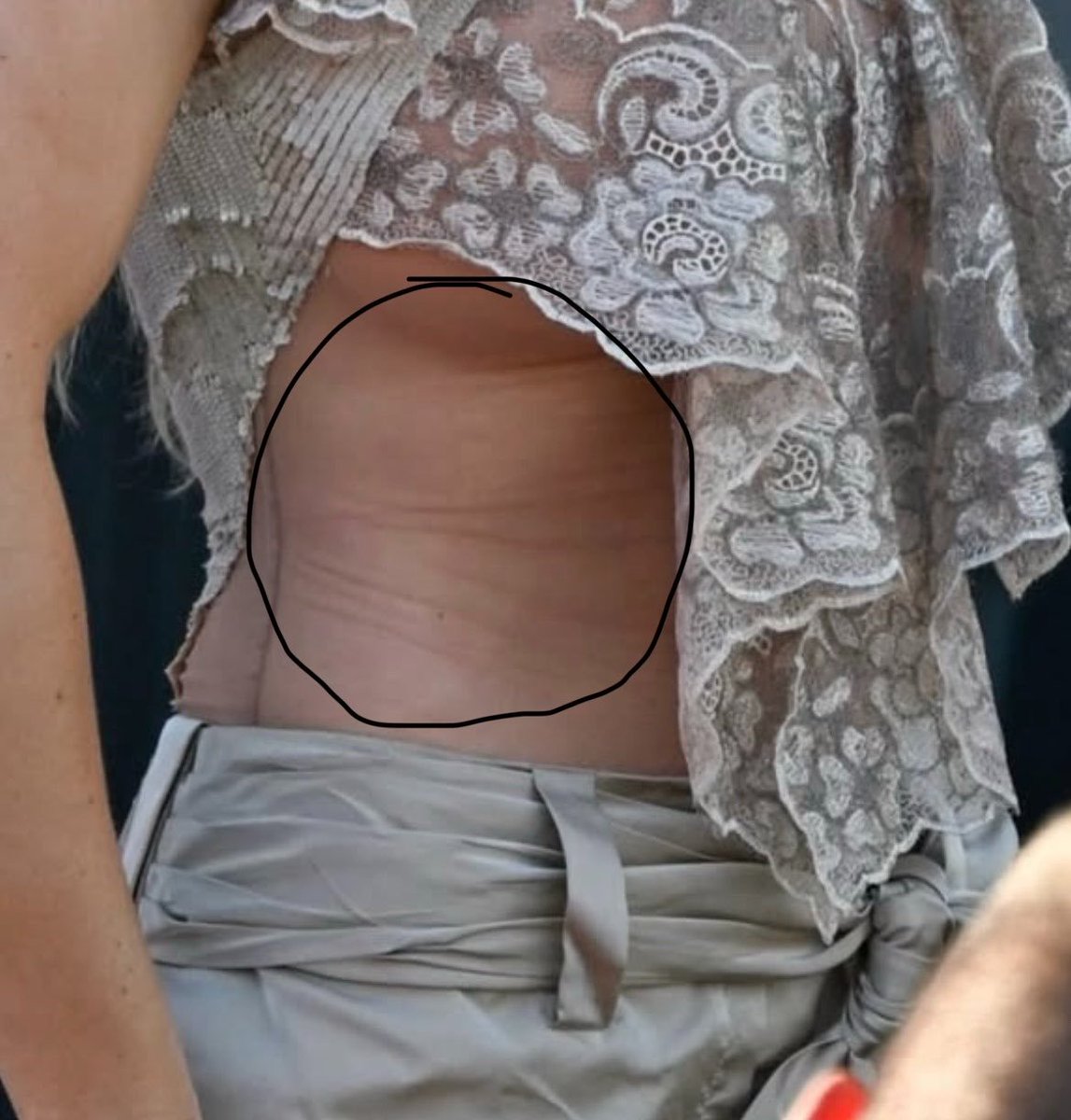 RocksYayo's tweet photo. @confusing_wot @grok tiene una camiseta o algo así tono piel casi transparente, de eso son las arrugas, se ve claramente la costura https://t.co/dG7XHGlZti