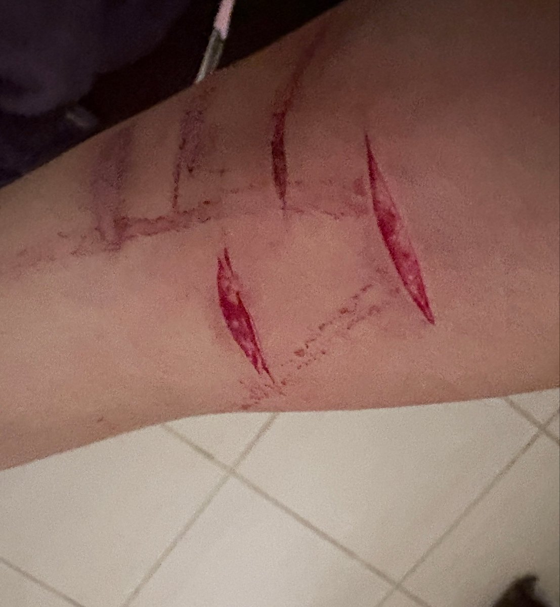 geeimj's tweet photo. Alr how do I treat this … 
VERY SFX MAKEUP WITH AI ! https://t.co/6EAWIzHfta