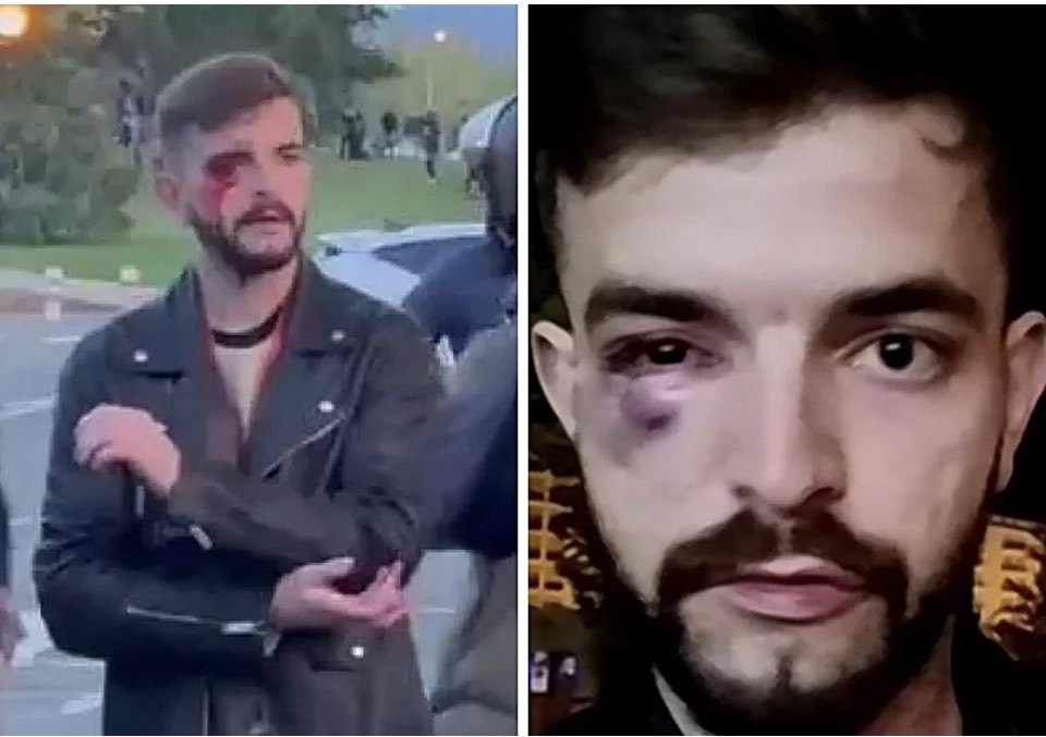 buba666's tweet photo. @_PabloFdez_ Por lo que sea no encuentro tu condena cuando otros le pegaron a este chaval, de hecho una amiga tuya que trabaja en canal red dijo en televisión que le habían pegado en defensa https://t.co/MnB3ygMEUi