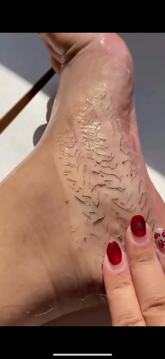euemillybn0's tweet photo. Gente… eu tô em choque até agora! a mulher que me ensinou como limpar o pele morta dos pés merece o mundo 🥹 eu sinceramente não sabia disso https://t.co/wi896346tH