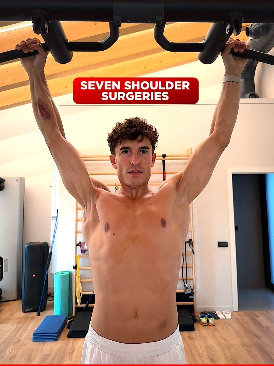 mgp1official's tweet photo. What seven different right shoulder surgeries do to a man: https://t.co/DvCPspTfas