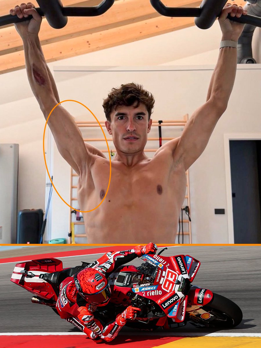 TheRaceMoto's tweet photo. That right arm has been through a lot and yet he is still fighting for his 10th World Championship. 

Marc Marquez is built different 👑 https://t.co/WoDetrB4ly