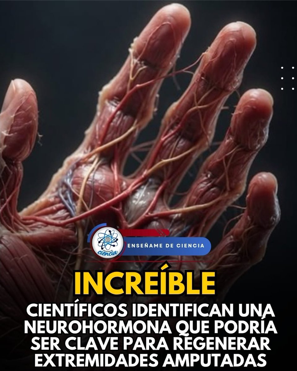 EnsedeCiencia's tweet photo. 🚨 ¡En un futuro, los humanos que han sufrido una amputación podrían tener la oportunidad de regenerar sus tejidos. Y, pasado un tiempo, tener nuevamente los miembros amputados!

Es un descubrimiento revolucionario dentro de la medicina y la ciencia, pues una neurohormona podría jugar un papel de gran relevancia en el área de la medicina regenerativa. De igual manera, se podría usar para desarrollar nuevos tratamientos para las lesiones de las extremidades.
