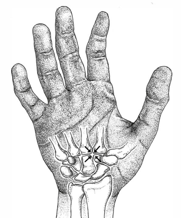 ServantSavio's tweet photo. @MrCasey62 "Not one of his bones will be broken." It's certain possible. And yes, it's unlikely, perhaps counts as a miracle, but that's exactly why it's noteworthy. https://t.co/AEKVfJQvWI
