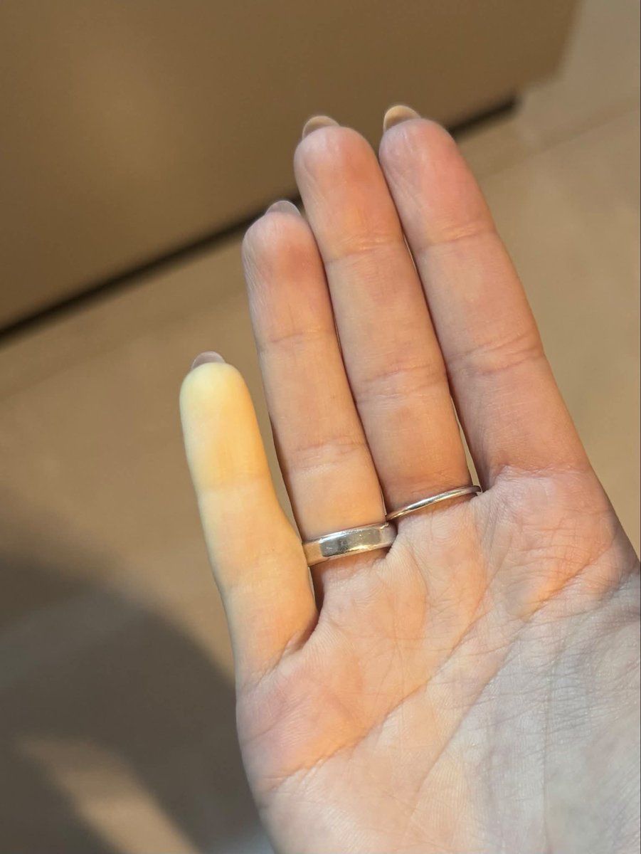 ElijahMarugp's tweet photo. Gente, do nada meu dedo ficou sem circulação por uns 15 minutos. Sem apertar, sem gelo, sem motivo nenhum. Fiquei só olhando. Isso é normal? https://t.co/Nx6smP1Asp