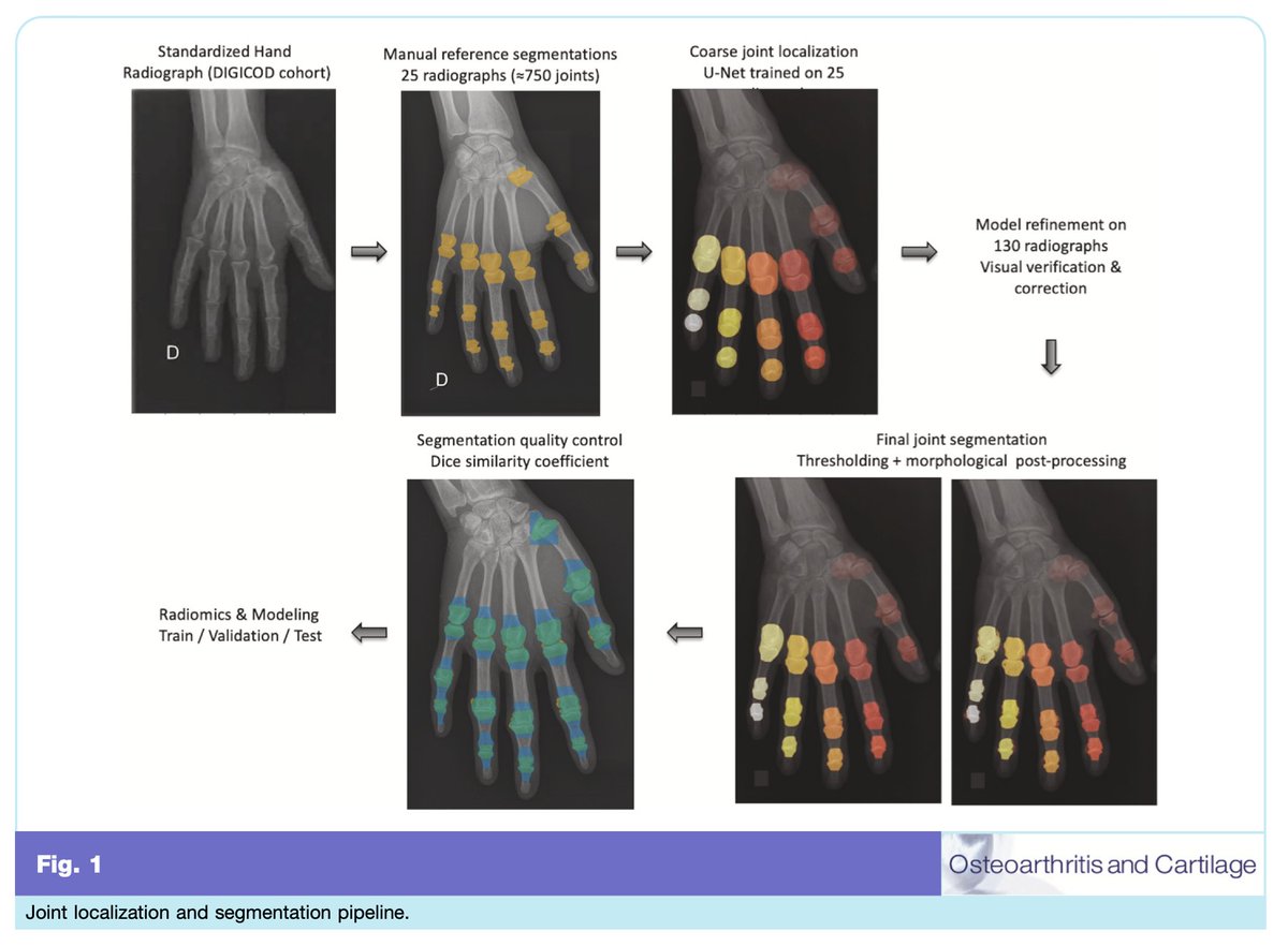 OACJournal's tweet photo. New this month!

Can #radiomics analysis of hand radiographs automate assessments of structural severity in hand #OA?

Read more from Laetitia Perronne et al. in this month's issue - https://t.co/10VL9AqsZi https://t.co/Ce8QkB1wgE