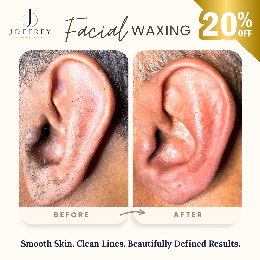 joffaesthetics's tweet photo. Trimming buys you three days. Waxing buys you a month.

20% off, limited time.

523 Chapala Street, Suite C-1, Santa Barbara. 

Book now:
https://t.co/yHjoZIvbeq

#santabarbara #montecito #mensgrooming #facialwaxing #sbgrooming https://t.co/vqr2NeFmRg