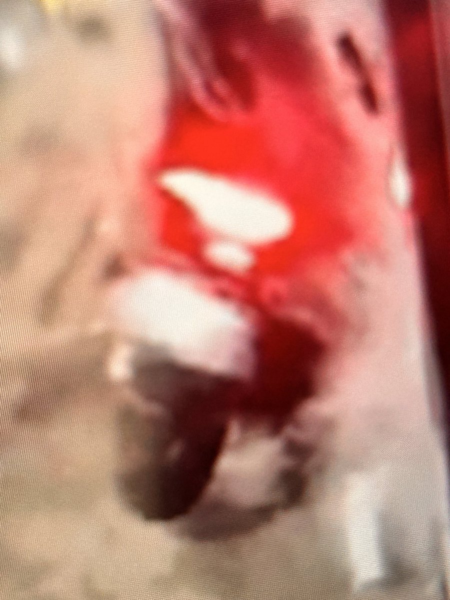 img_muamba's tweet photo. palhaços fogem em alta velocidade e provocam revolta https://t.co/cWKnZVggLU https://t.co/GwOZ1zoQBh
