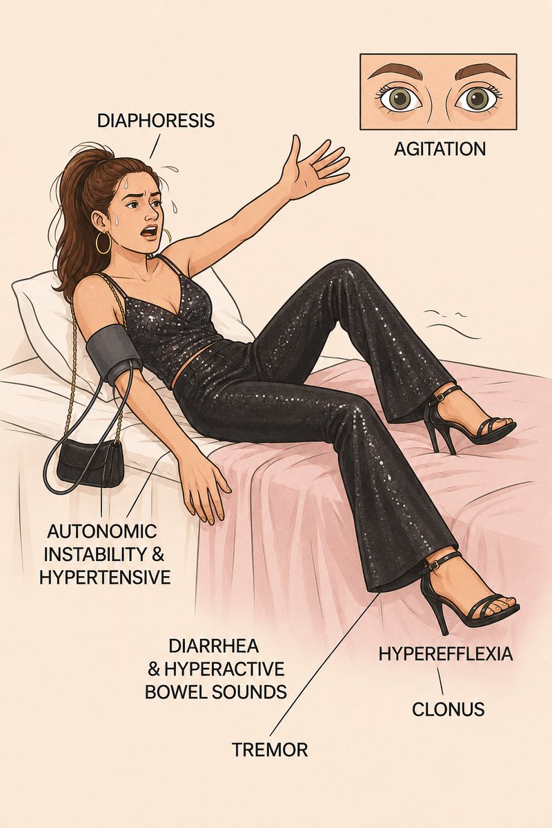 IhabFathiSulima's tweet photo. A 24-year-old woman is brought to the ED after an all-night dance party. She is agitated, drenched in sweat, hypertensive and tachycardic, with dilated pupils, tremor, hyperreflexia and inducible ankle clonus. She also has diarrhea and hyperactive bowel sounds.

What is the most likely diagnosis?