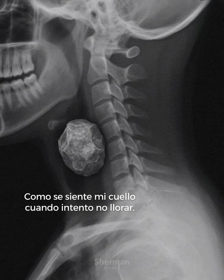 suspirxsalaire's tweet photo. https://t.co/f1TW9T57Js