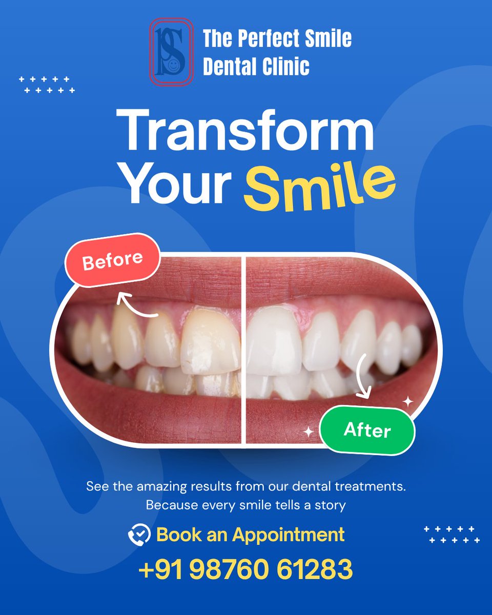 perfectsmile35's tweet photo. A smile transformation can change how you see yourself. Ready to transform your smile? ✨

#TransformYourSmile #PerfectSmileDental https://t.co/yUpA9s7rQ4
