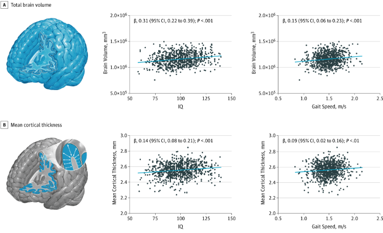 PlbtkBiz's tweet photo. Research finds fast walkers have higher IQ and larger brains than slow walkers https://t.co/PoI0qYj1SN