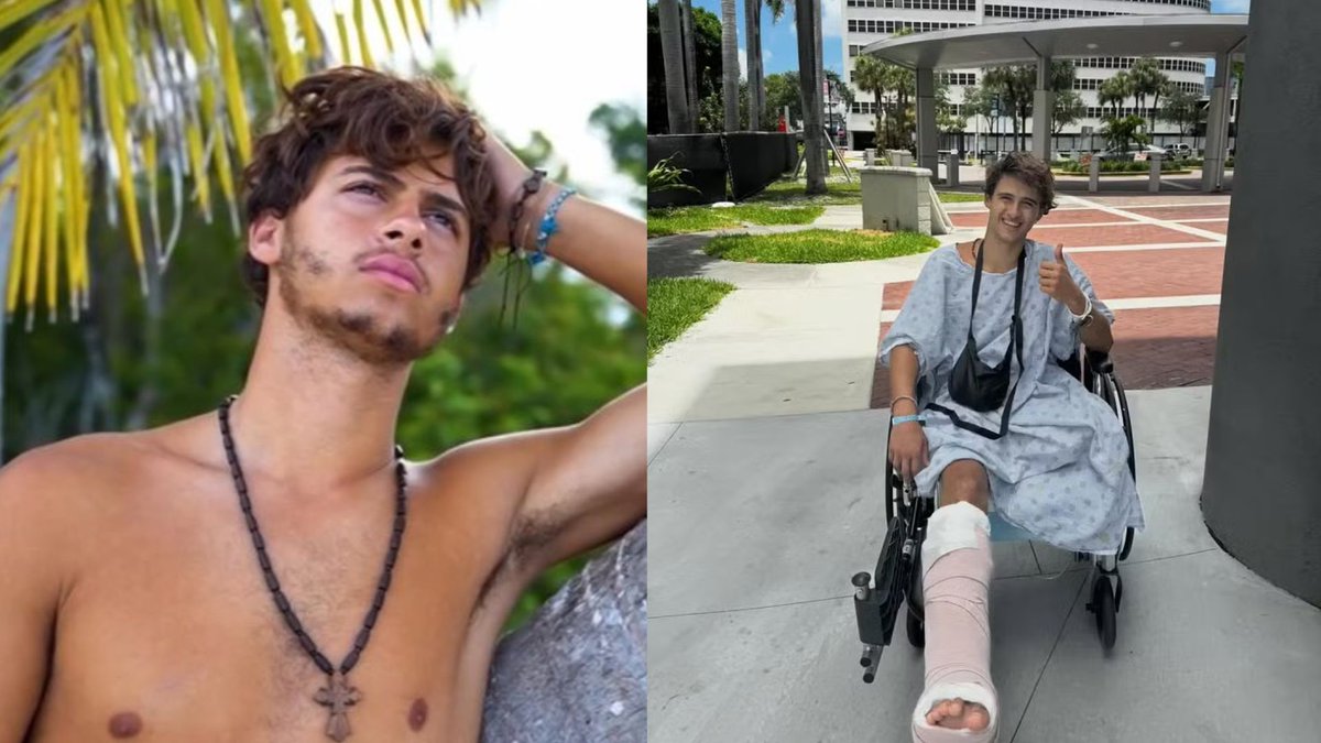 HugoGloss's tweet photo. Ex-participante de “Survivor” pede indenização milionária após perder a perna durante as gravações https://t.co/2ESE8Xcd5K (📷: Reprodução/ Instagram) https://t.co/FdgdshDp2g