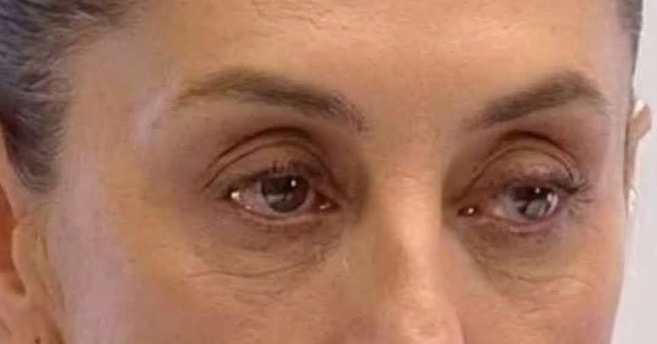 lunadeandromeda's tweet photo. LES DIGO QUE LA TIENENQUE DROGAR PARA QUE PUEDA SEGUIR EL GUION DE MENTIRAS.....UN DÍA LE DURÓ A CLAUDIA SHEINBAUM SU INFORME DE MENTIRAS: HOY LE SACARON LA CUENTA.
Ayer Claudia nos contó que vivimos en el país de las maravillas. Hoy Carlos Loret de Mola le puso enfrente la factura del verdadero informe: el octavo año del gobierno de Andrés Manuel López Obrador y sus caprichos mantenidos con nuestro dinero.
 Mexicana pierde $2.5 millones diarios, ya nos costó casi $40 mil millones y la mitad de sus asientos vuelan vacíos.
 El Tren Maya acumula pérdidas por $14 mil millones y acaba de descarrilarse otra vez.
 El Interoceánico iba a costar $20 mil millones y ya va en $62 mil millones. Sus ingresos apenas cubren el 3% de sus gastos; suma seis siniestros y el más grave dejó 14 muertos.
 Dos Bocas costaría 8 mil millones de dólares, ya va en 21 mil millones y solamente opera al 41% de su capacidad.
 Gas Bienestar prometía gas barato para todo México. Recibió una inversión inicial de $4,500 millones, acumula costos por $2,500 millones, apenas opera en nueve alcaldías y deja cero pesos de utilidad.
 El AIFA lleva cuatro años sin alcanzar sus metas de pasajeros. Ni el Mundial pudo hacerle el milagro.
 La Megafarmacia quedó abandonada. Fue tan “exitosa” que Sheinbaum ahora hará exactamente lo contrario: miles de pequeñas farmacias.
LitioMx no tiene litio, no extrae litio y no produce nada… pero ya gastó $40 millones en nómina. ¡Para cobrar sí resultaron buenísimos! 
¡Qué eficiencia! No producen utilidades, gas, medicinas ni litio, pero las pérdidas y las nóminas llegan puntuales.
Y eso sin incluir narcopolítica, corrupción, deuda récord, caída en la calificación crediticia ni los resultados de “abrazos, no balazos”.
¿En qué página del informe de Claudia venía toda esta maravilla de la 4T que ayer nos contó?
