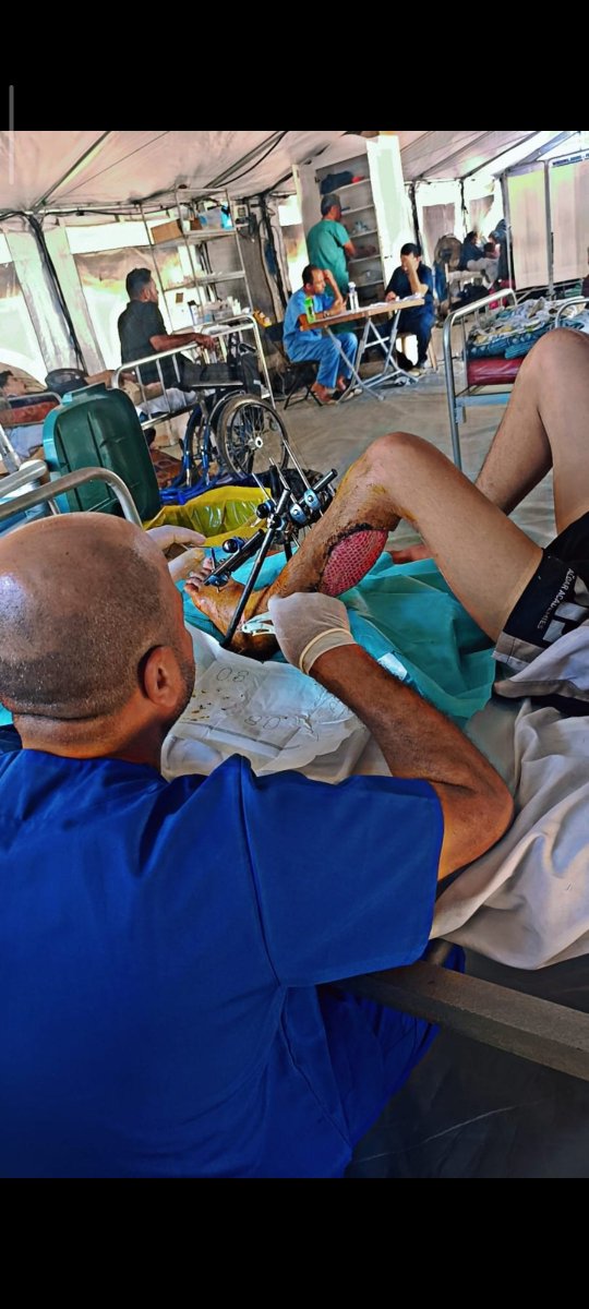 fatma_fouda3's tweet photo. This is my brother Youssef in Gaza. He suffered severe injuries to his leg, requiring complex surgeries, skin grafts, and external fixation to save it from amputation. 💔
https://t.co/QspVi14KQ5
#momsonn #MuhtemelAşk https://t.co/DPD2HEccbw