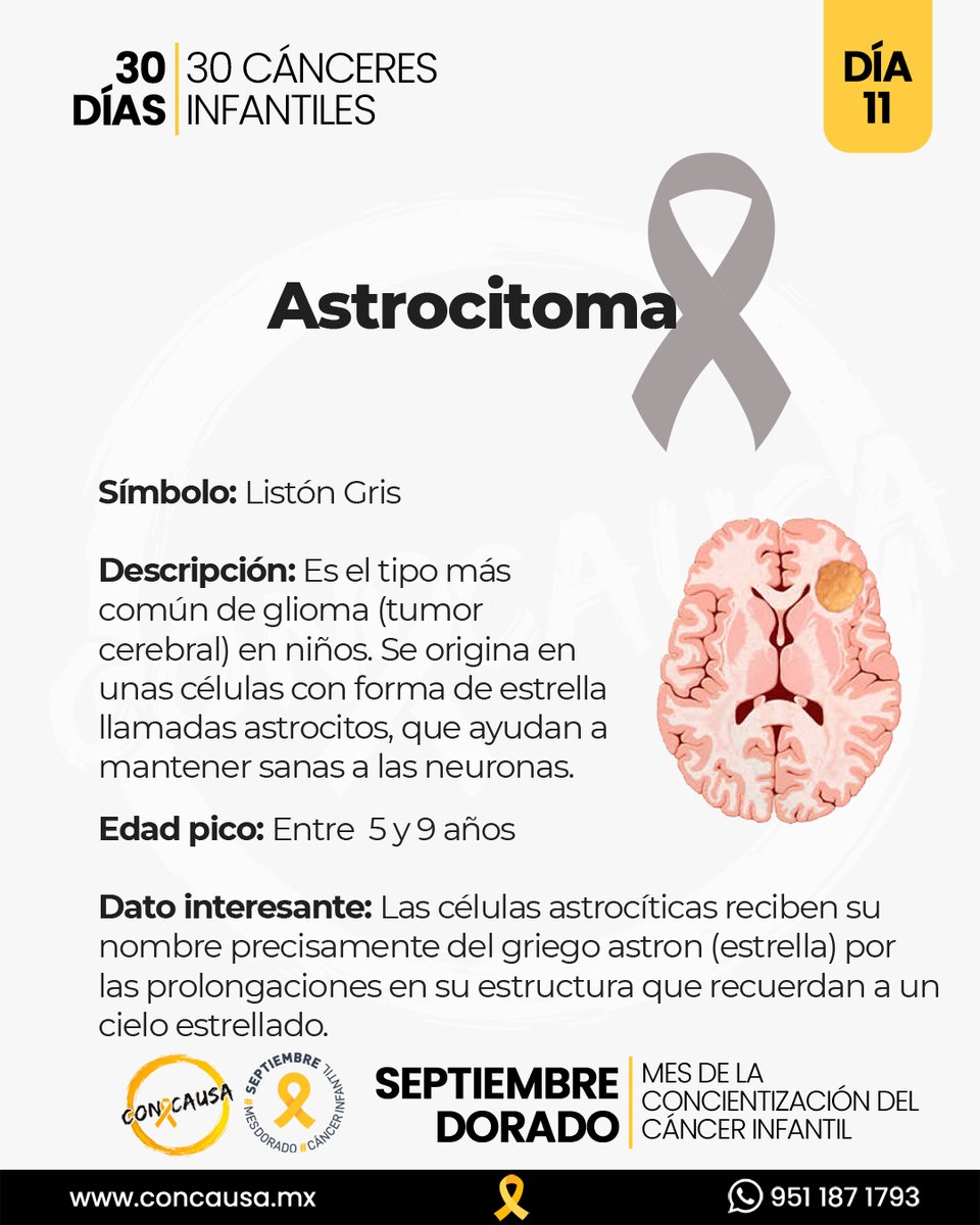 ConCausaMX's tweet photo. 30 DÍAS / 30 CÁNCERES INFANTILES: Astrocitoma

#SeptiembreDorado #CáncerInfantil #30Días30Cánceres #ConCausa https://t.co/LkkuF9Cxwx