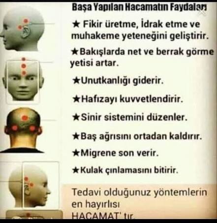 yusufcekic45's tweet photo. #NeMutluTürkümDiyene #BuVatanBizim #saglikliyasam #sağlıklıyaşam #pratikyemekler #huy #kütahya #Konya #kayseri #Trabzon #usak #zonguldak #kastamonu #tunceli #Adiyaman #sanliurfa #hayat #yaşam #çay #mutluolyeter #şifa #güzellik #kütahya #asayiş #Pratik #zeka #pratik #düşünce https://t.co/Do70carzdQ
