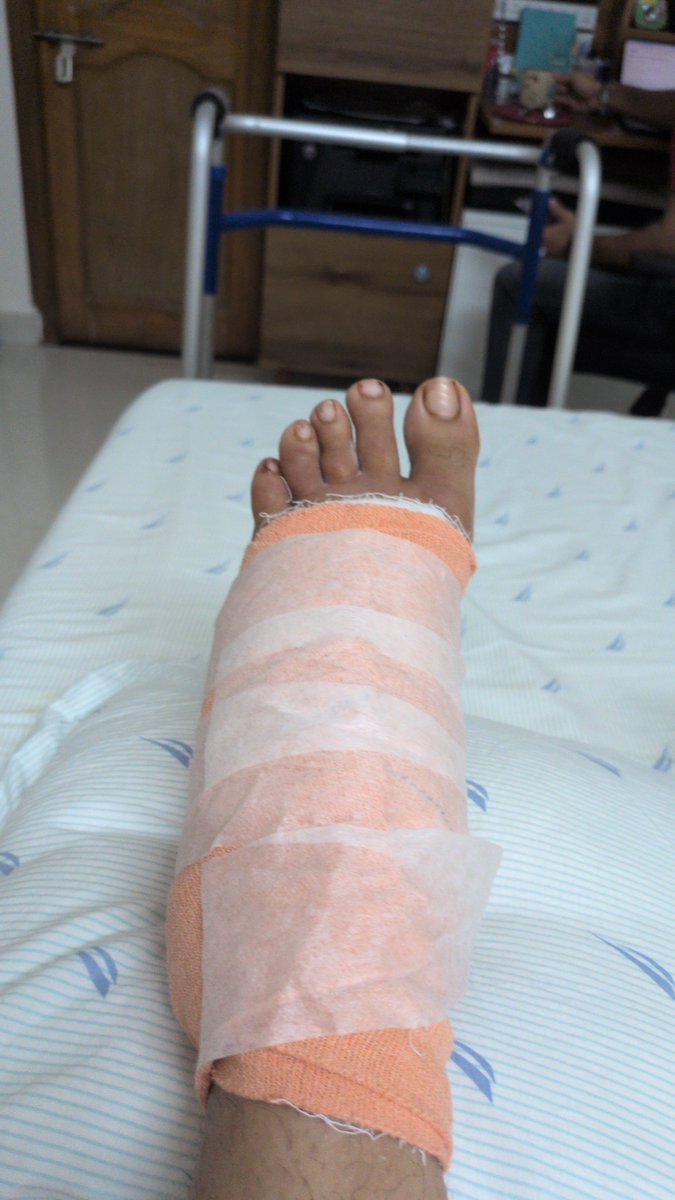 Aishani_Khanna's tweet photo. @krishnabgowda ACCIDENT on Aug 20 due to an unmarked, waterlogged pothole on the Varthur stretch.Result: crushed ankle, 7–10cm deep cuts, emergency plastic surgery, 5 days at Manipal Hospital, and ₹1.97L in bills—with another surgery pending.
@BBMPCOMM @GBA_office
Fix Varthur Stretch in 15 day https://t.co/sDdiHk9xgH