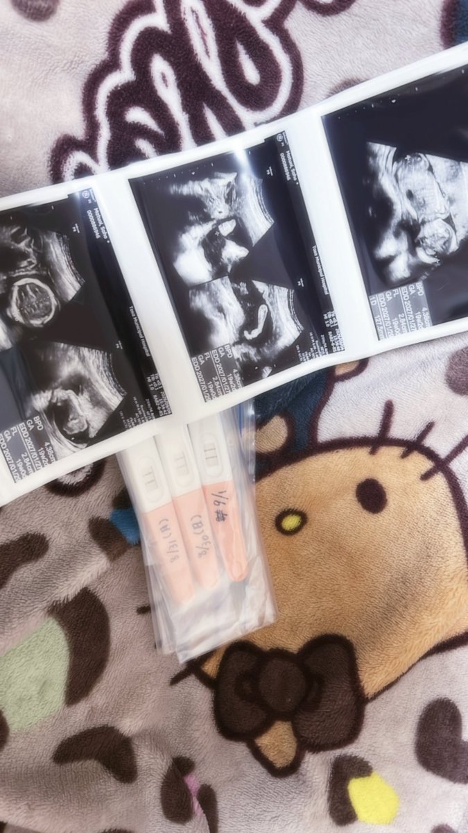 Love_Queen_01's tweet photo. 私事ではありますが、バリ元気そうな男の子できました！エコー中動きすぎて写真撮れん言われたあげく人の腹の中で偉っそうに足組んでました！ https://t.co/AndGNL5dky