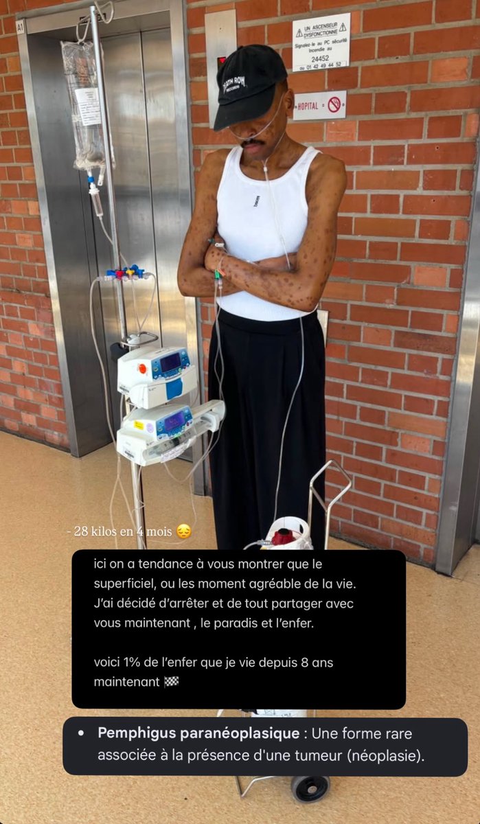 _RapMinute's tweet photo. Tout notre soutien à Prince Waly qui combat en ce moment la "Pemphigus paranéoplasique" 🤍 https://t.co/hFRft6jk8j