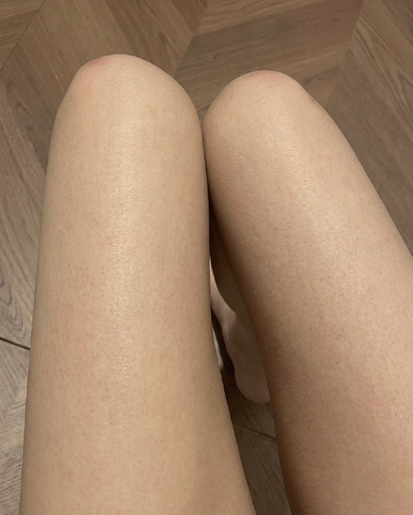 n5rdym's tweet photo. え、これガチやばい。白玉点滴週4で通ってた時くらい白くなったんだけど。 https://t.co/r3q0rtTZ41