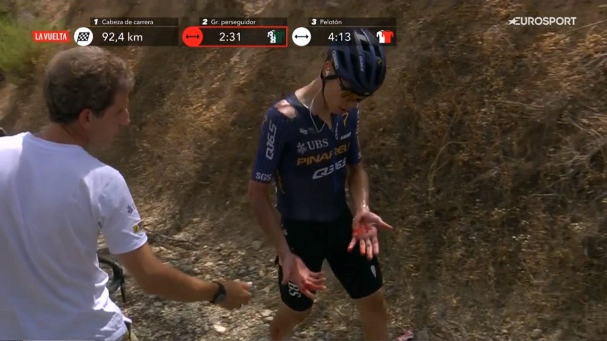 LucGrefte's tweet photo. This is why you wear gloves, kids https://t.co/UIFuTwxyZV