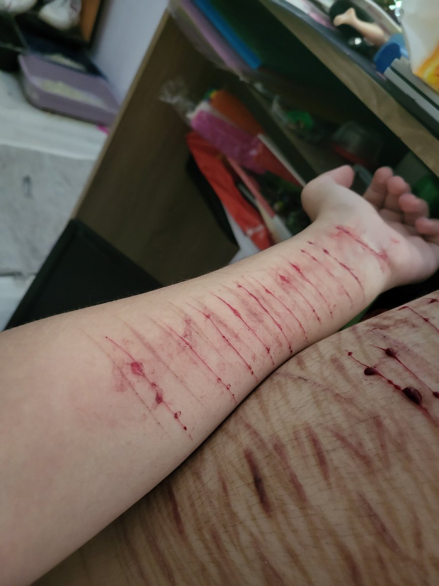 1c4ntbr34th3's tweet photo. ALL FAKE AI GENERATED!!!! 
SFX Halloween costume practice
Don't report, scroll. 

From last time haha, I wish I had an older woman in my DMs👀 like really wish I had one, I'm 17 btw

All fake makeup
SFX makeup for upcoming Halloween movie https://t.co/CNaiE3IswH