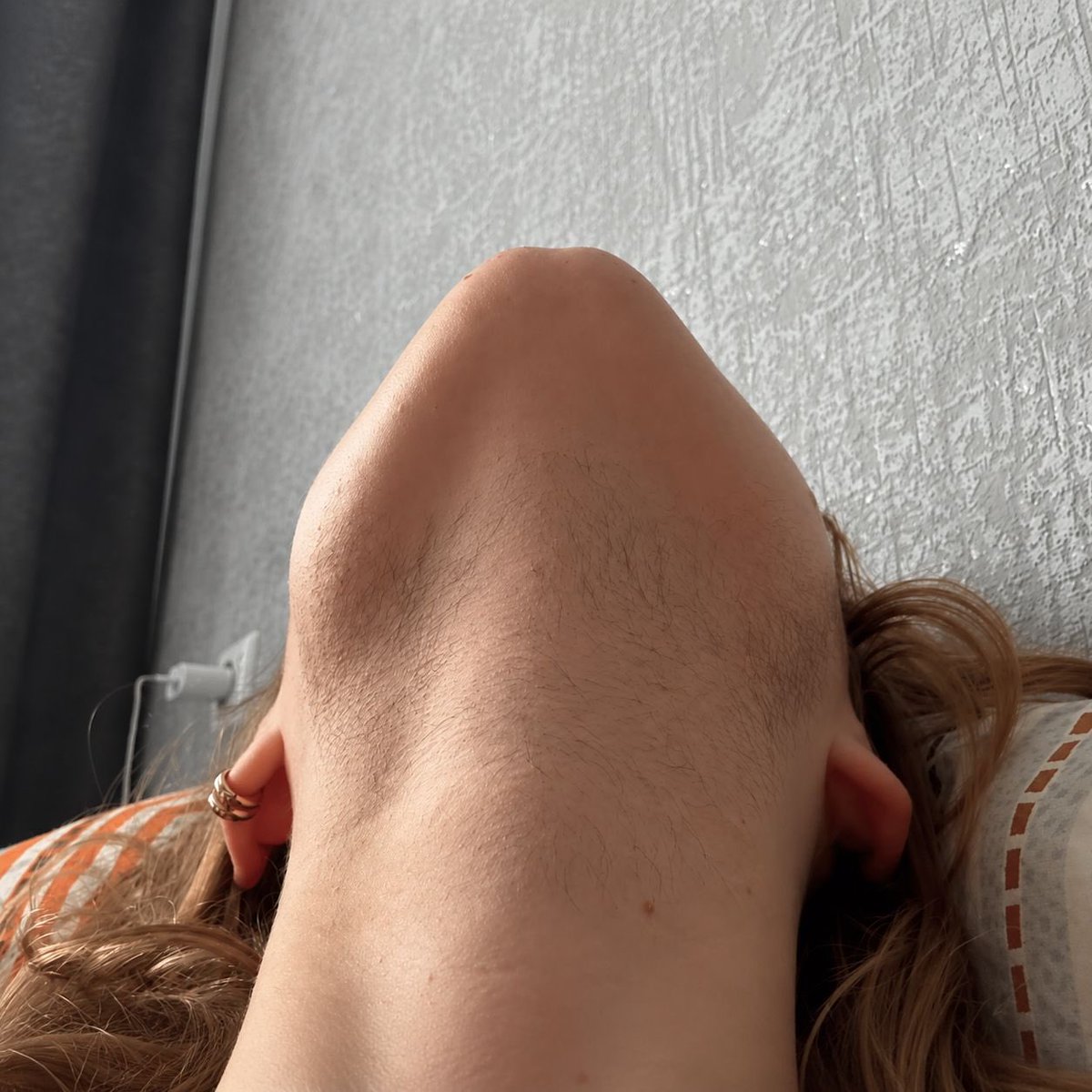medoyia's tweet photo. Bir kadının çenesinde böyle kıllar çıkması normal mi??? Gerçekten çok kötü gözüküyor. Geçici bir şey mi? Bu sorunu başka yaşayan var mı? https://t.co/lZXtfn94vy