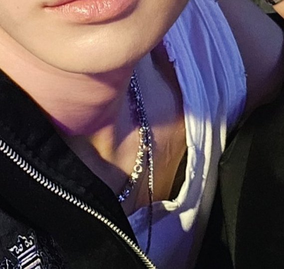 highwaymelody's tweet photo. In dec 2023 fancall a fan noticed the scar under his right collarbone n asked if he was hurt. He asked "how do u know?" then said it was previous wound n reassured her with "ofc!" when asked if he's okay. Realizing that mark could be around the area of a lymph node biopsy scar🥺 https://t.co/00yoFxZuCL