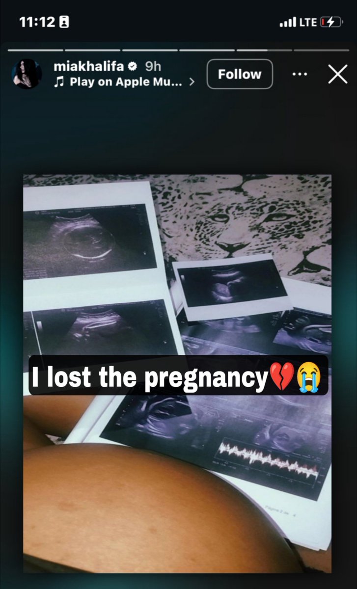 BigMickey_02's tweet photo. Mia Khalifa broke down in tears after losing her first pregnancy to a miscarriage, which she believed was caused by several previous ab0rtions.

“I always thought that maybe one day i could become a mother and have children of my own. You know, taking them out, bathing them, playing with them and watch them grow. That was all i ever wanted. But unfortunately, I didn’t know i was wrong. My doctor always warned me to stop having abortions, but i never listened. It’s so devastating to realize that i may no longer be able to become the mother i always dreamed of being.”